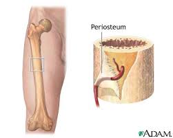 perthes disease