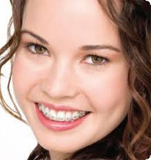 braces pictures