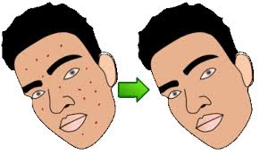 zit tool