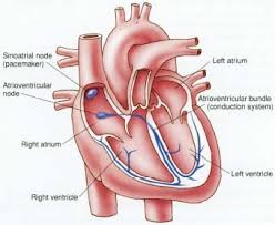 heart pacemaker