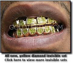 invisible sets2 Me voy a quitar el oro de las muelas