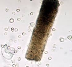 atlas of urinary sediment
