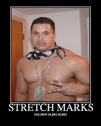 stretchmarks