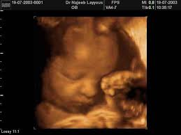 3d ultrasound pictures