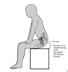 sore tailbone