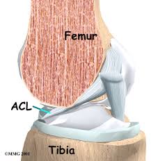 acl
