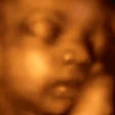 3d 4d ultrasound pictures