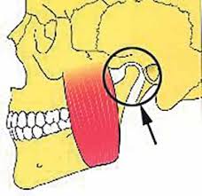Me ha empezado a doler bastante la mandibula al masticar 587 0 Me ha empezado a doler bastante la mandibula al masticar