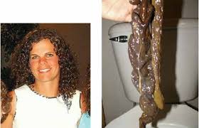 cleansing bowel