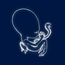 sigur ros albums