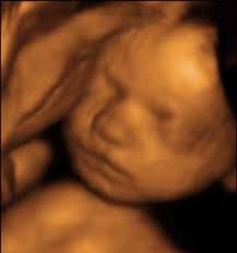 3d ultrasound pictures