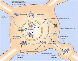Huntingtons Disease