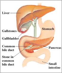 treating pancreatitis