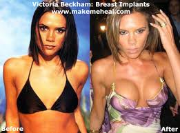 fake boobs