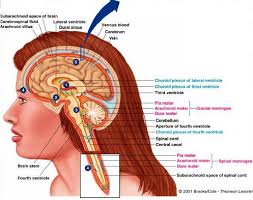brain cyst