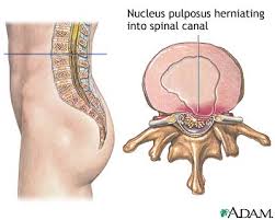 nucleus