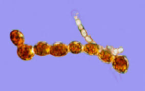 Attēlu rezultāti vaicājumam “Trentepohlia sp.”