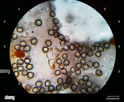 Attēlu rezultāti vaicājumam “Physarum psittacinum spores”