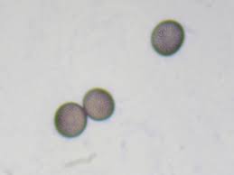 Attēlu rezultāti vaicājumam “Badhamia panicea”