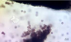 Attēlu rezultāti vaicājumam “Physarum melleum stalked”