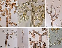 Attēlu rezultāti vaicājumam “Stemonitopsis aequalis var. microspora macro”