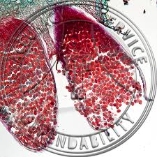 Attēlu rezultāti vaicājumam “Puccinia coronata”