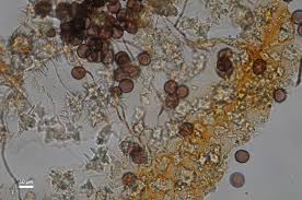 Attēlu rezultāti vaicājumam “Didymium bahiense spores”