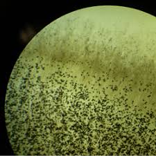 Attēlu rezultāti vaicājumam “Badhamia melanospora spores”