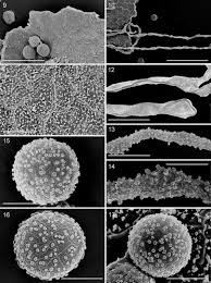 Attēlu rezultāti vaicājumam “Perichaena corticalis spores”
