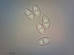 Attēlu rezultāti vaicājumam “Sowerbyella radiculata”