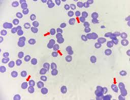 Attēlu rezultāti vaicājumam “Cribraria purpurea plasmodium”