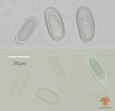 Attēlu rezultāti vaicājumam “Mycoblastus sanguinarius”