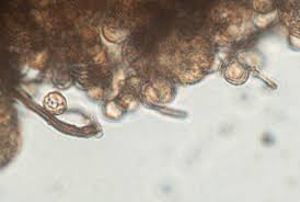 Attēlu rezultāti vaicājumam “Comatricha pulchella spores”