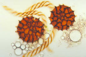 Attēlu rezultāti vaicājumam “Fossombronia wondraczekii spores”