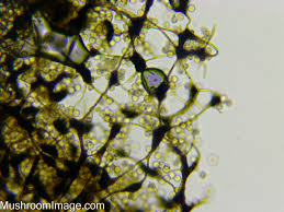 Attēlu rezultāti vaicājumam “Cribraria cancellata var. fusca spores”