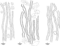 Attēlu rezultāti vaicājumam “Sidera lenis”