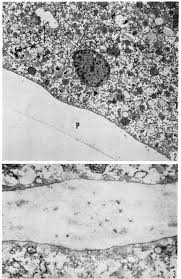 Attēlu rezultāti vaicājumam “Arcyria cinerea young”