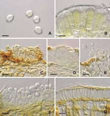 Attēlu rezultāti vaicājumam “Coleosporium sp.”