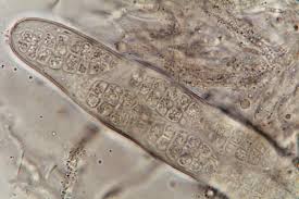 Attēlu rezultāti vaicājumam “Licea castanea spores”