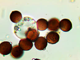 Attēlu rezultāti vaicājumam “Didymium difforme macro”