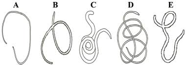 Attēlu rezultāti vaicājumam “Nematomorpha”