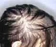 Womens Safety In India: Girl Dead, Mother Hurt After Being Thrown.