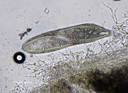 Attēlu rezultāti vaicājumam “Pertusaria pertusa”