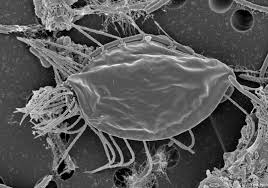 Attēlu rezultāti vaicājumam “Arcyria stipata”