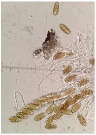 Attēlu rezultāti vaicājumam “Stemonitopsis aequalis var. microspora macro”