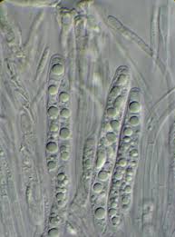 Attēlu rezultāti vaicājumam “Coenogonium pineti”