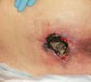 Diseases Treatments - Diseases Pictures Causes Symptoms - Part 18
