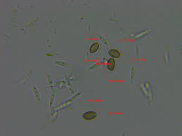 Attēlu rezultāti vaicājumam “Amaurochaete atra spores”