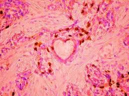 Attēlu rezultāti vaicājumam “Licea minima macro”