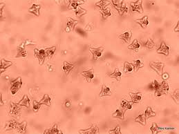 Attēlu rezultāti vaicājumam “Didymium nigripes spores”